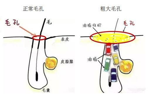 收缩毛孔的5款最佳产品,有什么好用的收缩毛孔系列