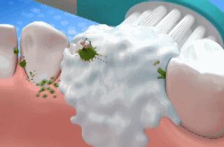 牙齿变黄你真的刷对了吗,牙齿黄了怎么办不用花钱去洗牙