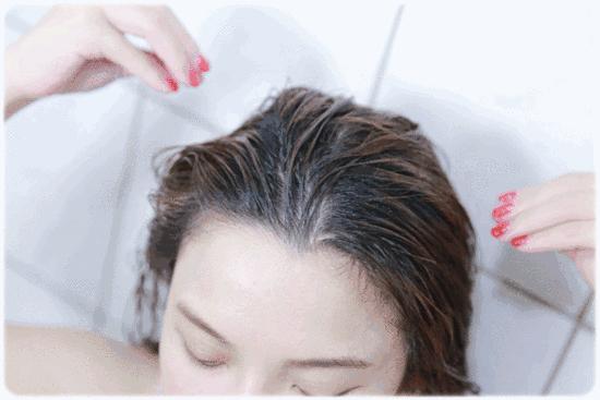 头上头皮屑和剪发虫怎么解决,头皮屑多和肚子里有虫有关系吗