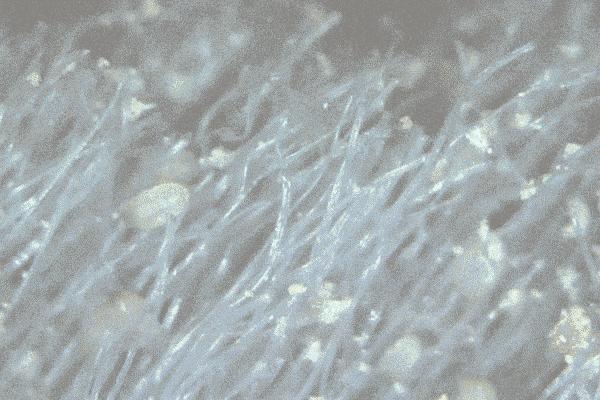 鑼佃姯鍐呰。娲楁姢鍑濋湶,宕囧Э鍐呰。娓呮磥鍑濋湶