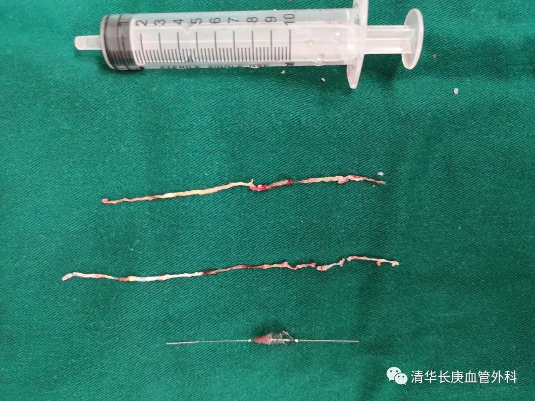 教学相长共同成长,北京清华长庚医院周围血管外科