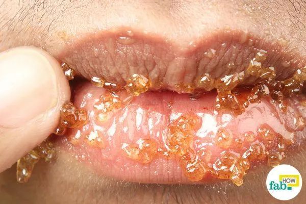 蜂蜜加白醋怎么使用效果好,蜂蜜加白醋的吃法一定要知道