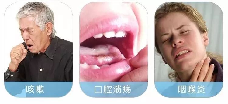 20年烟民咽喉发黑，瑞士专业医师推荐！一喷杀菌99.9%，止咳清痰排烟毒