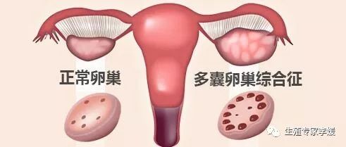 闭经如何治疗最好,闭经的中医治疗