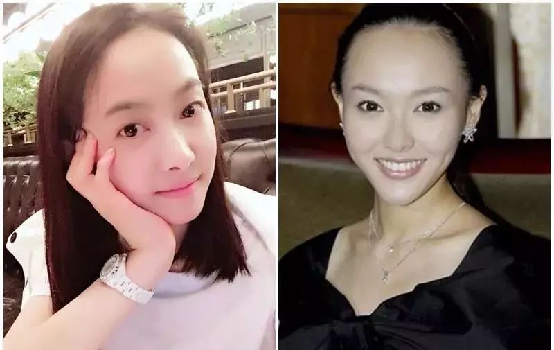 疯狂掉头发发际线后移,疯狂掉头发头发变得稀疏