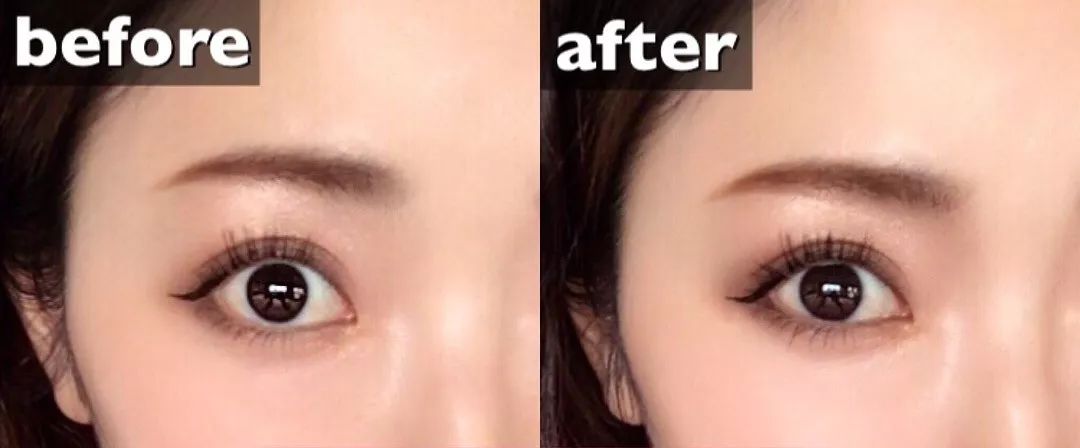 怎么调整眉眼距,怎么样才能增加眉眼间距