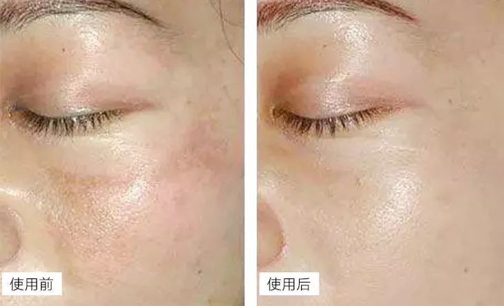 “从LAMER用回片仔癀”！国货药妆之光，奶奶辈就在用，国外买价格翻5倍