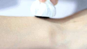 痘痘黑头清理方法,彻底解决痘痘黑头