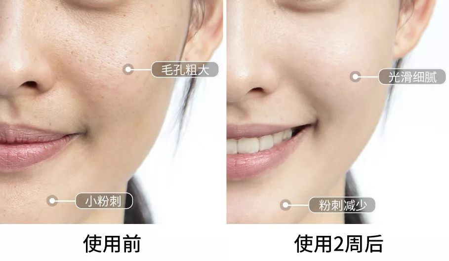 逆天了！男人最想娶的处女脸女神，竟然43岁了！