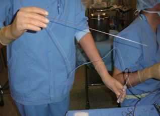 未婚女孩捐一次卵有危害吗,女性捐卵子对身体有伤害吗