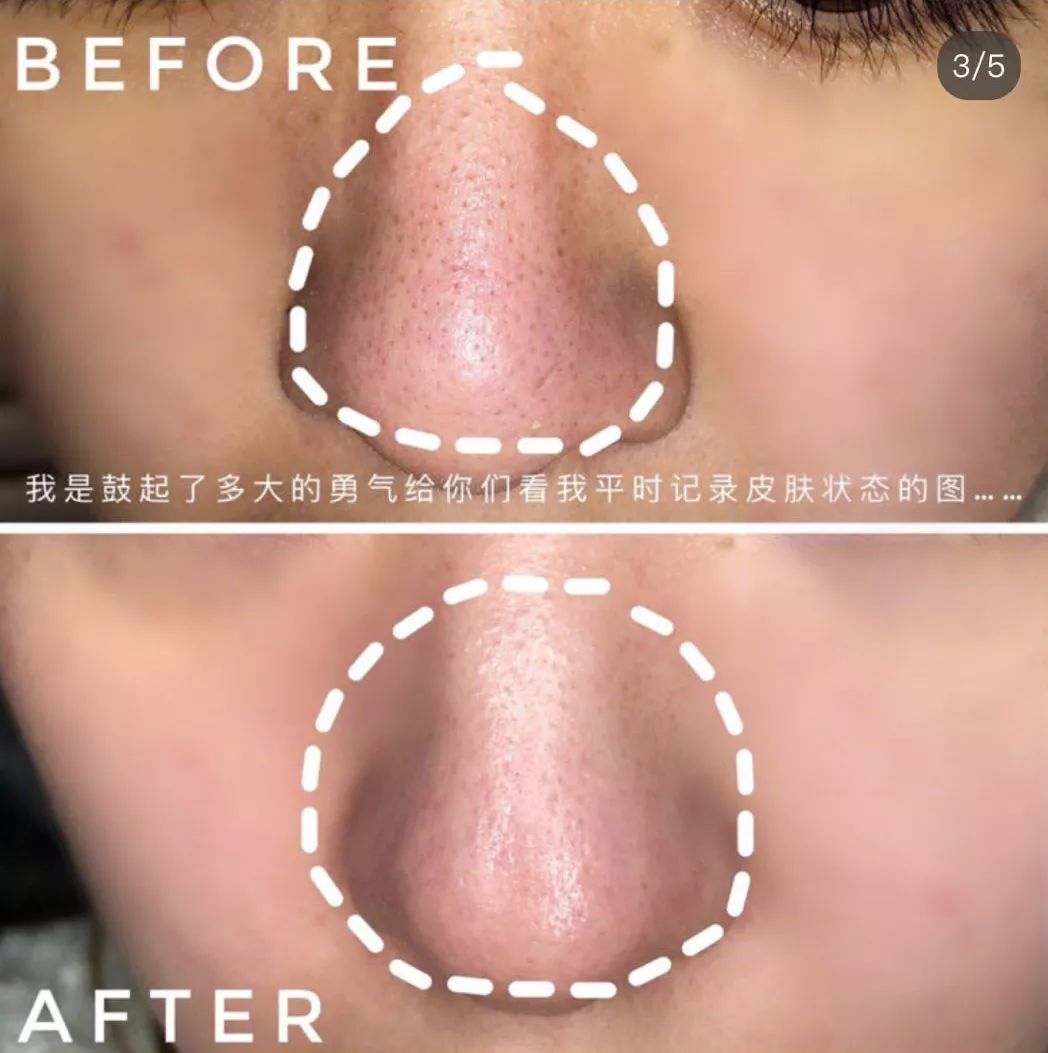 美容院的美容仪器需要投资多少钱,美容院哪些项目值得做仪器