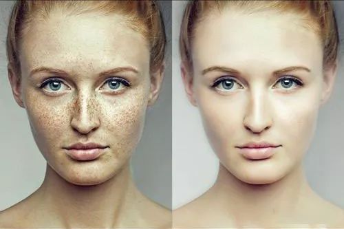 5个祛斑小妙招淡化晒斑雀斑痘印,痘印晒斑和疤痕用什么产品比较好