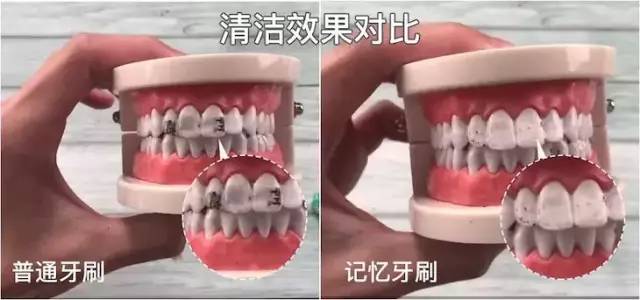 记忆手柄牙刷，刷新想象！1支=5支普通牙刷+1瓶漱口水+1瓶口香糖