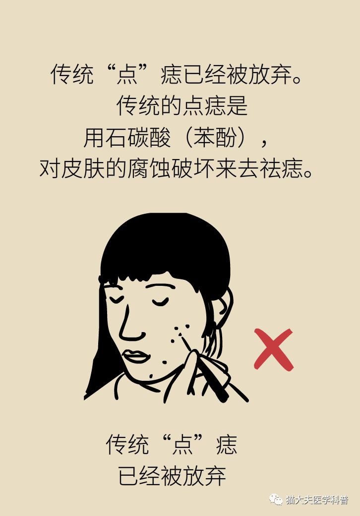 什么症状表明痣已经在恶变,先天性黑素细胞痣恶变的概率大吗