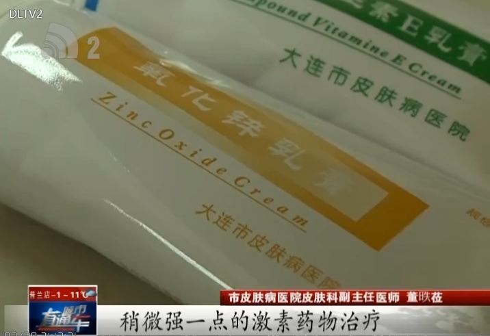 治疗湿疹的非激素进口药膏有哪些,湿疹天然药