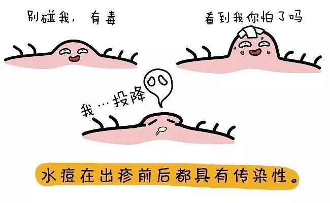 大人护理儿童水痘的防范措施,孩子水痘大人预防