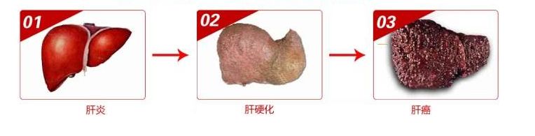 天然强肝剂护肝排毒,护肝排毒产品