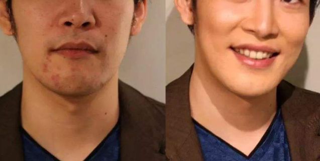 天然强肝剂护肝排毒,护肝排毒产品