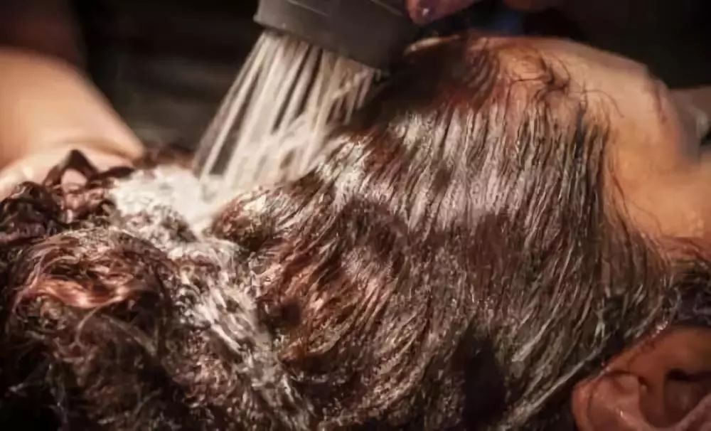 头皮屑多的解决方法小妙招,头皮屑突然增多的原因和解决方法