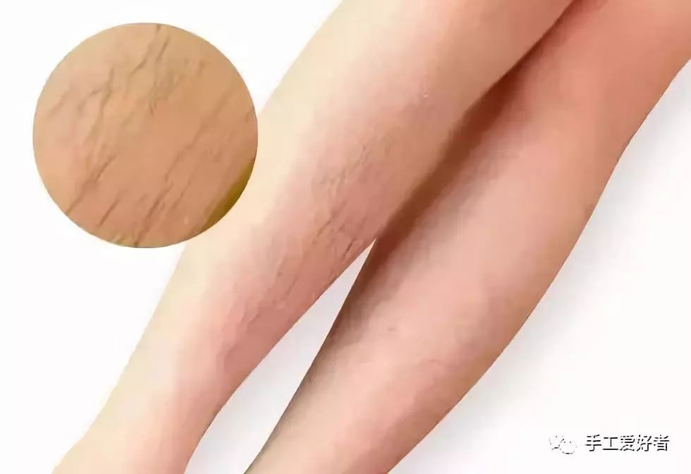 平价又好用的脱毛神器学生党温和,英国脱毛最好的产品适合学生党