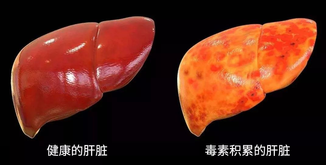 天然强肝剂护肝排毒,护肝排毒产品