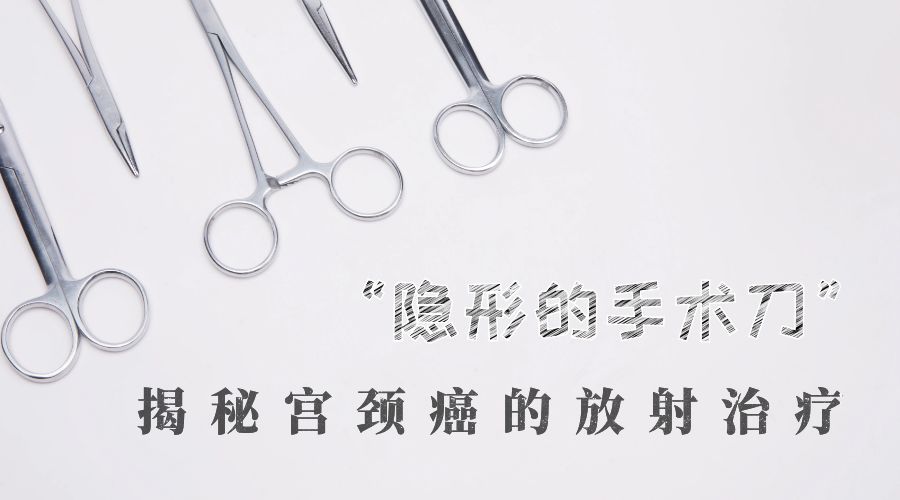 “隐形的手术刀”—揭秘宫颈癌的放射治疗（下）