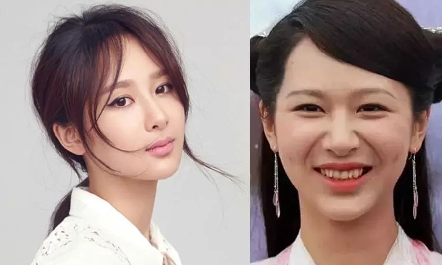 杨紫法令纹填充过多像小猴子,杨紫法令纹和嘴角纹怎么这么深