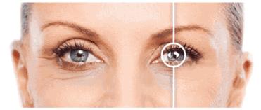 德国变态震动棒，啪啪啪间抚平眼袋、黑眼圈！不用开刀，就能让你年轻十岁！