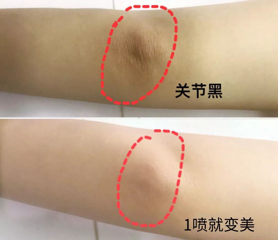 裸感美腿|1瓶=20双*袜丝**！3秒喷出“裸感”大美腿！隐形毛孔、鸡皮肤！短裙绝配