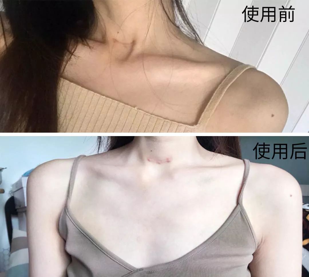 裸感美腿|1瓶=20双*袜丝**！3秒喷出“裸感”大美腿！隐形毛孔、鸡皮肤！短裙绝配