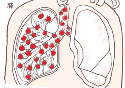 小编推荐丨缓解咳嗽、口臭，试试这个“千金方”！澳洲纯植物提取