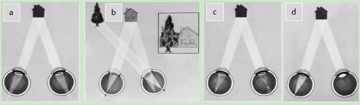 先天弱视成因,弱视的诊断和治疗方法