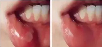 俄罗斯牙膏美白去口臭牙黄,去牙垢黄牙的牙膏测评