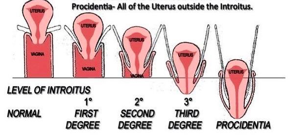 没有一个女人可以笑着走出婚姻,没有一个女人能笑着走出来
