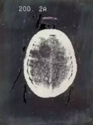 农场里走出CT鼻祖，美苏核危机诞生磁共振！