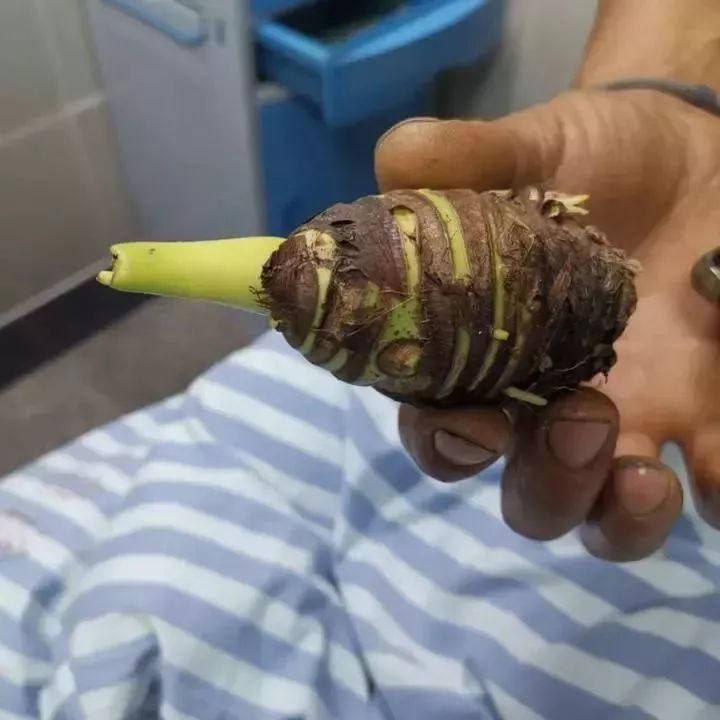 青田人注意！碰了一下就中毒，严重者可致命！这个毒物很多人家里有