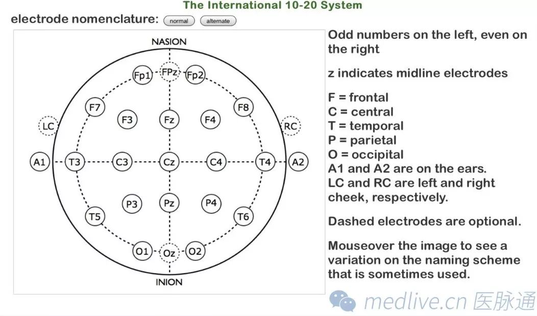 正常脑电图报告单图片,正常脑电图检查报告单第一页