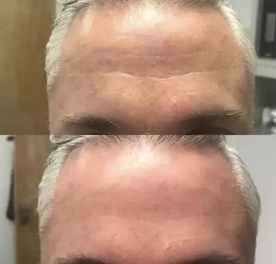 熬夜急救大牌面霜,熬夜急救涂抹大牌面膜