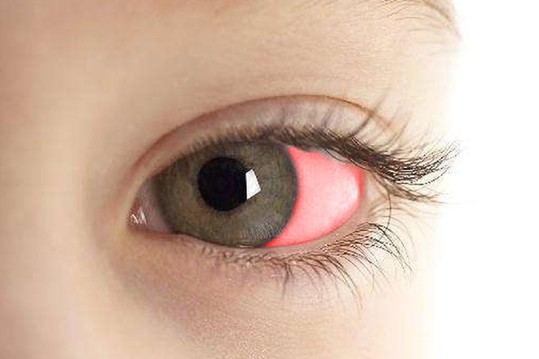 科普眼底出血是怎么回事,科普眼睛里为什么会有黑点