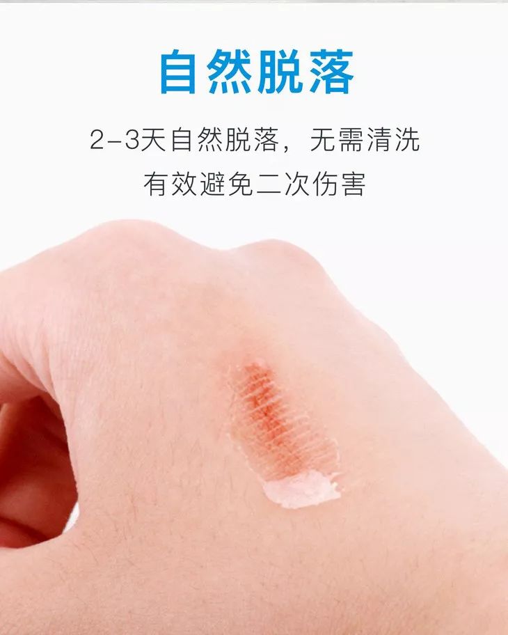 喷雾式防水创可贴,液体创可贴有效果吗