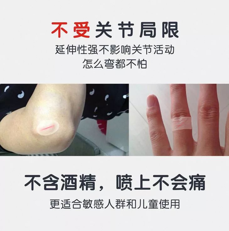 喷雾式防水创可贴,液体创可贴有效果吗