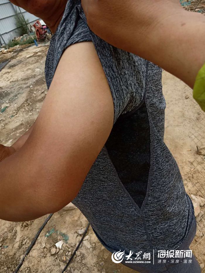 致敬高温下的菏泽户外工作者：手臂晒出“黑白分界线”