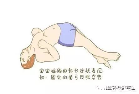 脑瘫的孩子就一定智力有问题吗,脑瘫的人有智力吗