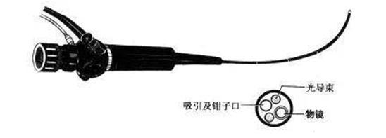 鱼刺卡喉轻松解决快1年了,鱼刺卡喉咙医院怎么处理