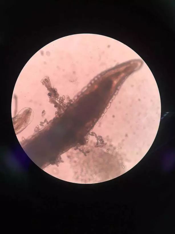 可怕！杭州4岁宝宝老是挠屁屁，大半夜还爬出白色小虫