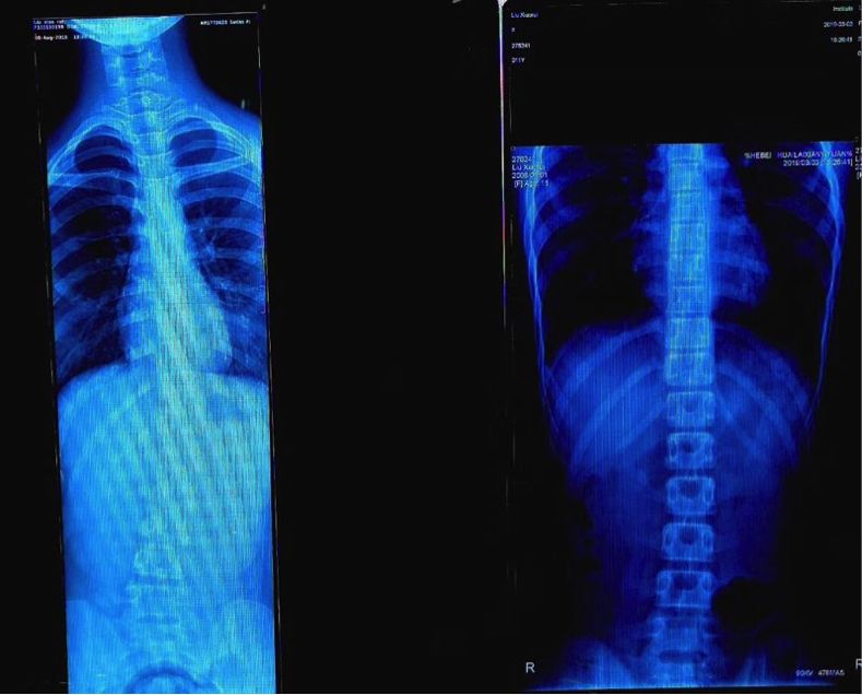 学生体育知识问答,关于儿童体育运动方面提出的问题