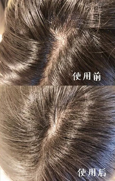 OMG！均价只要30元！这23款屈臣氏好物，明星都爱用