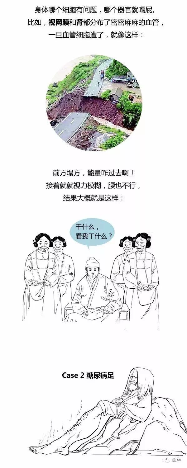 糖尿病科普知识漫画视频,糖尿病人寿命长短漫画