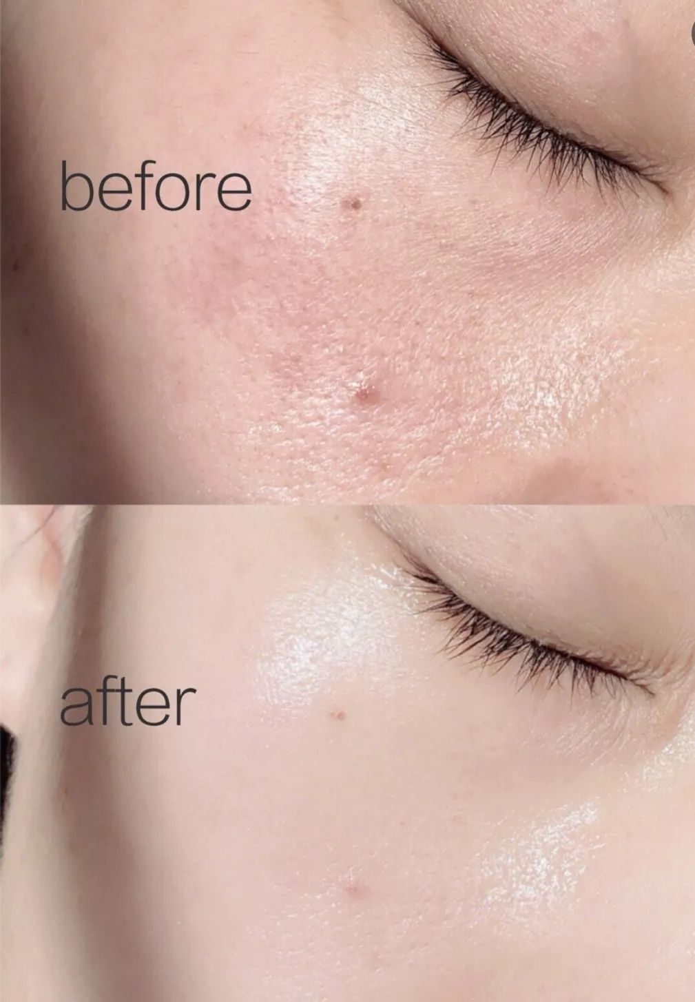 有必要用哪一款水乳,一辈子就能用一套水乳