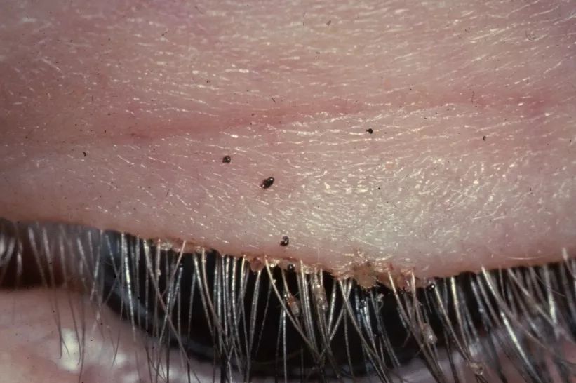 和隐翅虫差不多的黑色吸血虫,少见的吸血虫